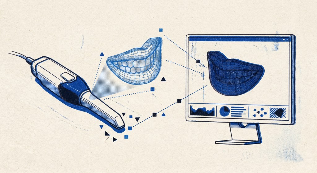 Blue Risograph illustration of an intraoral dental scanner projecting a 3D wireframe smile model onto a clinical computer monitor, representing digital dentistry workflows.